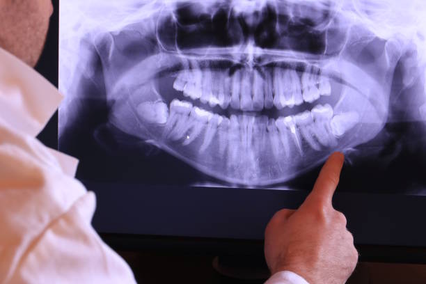 Best Emergency Cosmetic Dentistry in Terrebonne, OR